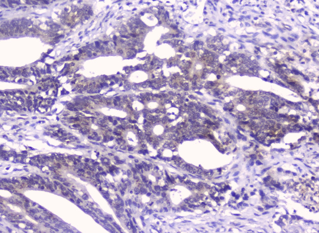 GOLPH3 Antibody in Immunohistochemistry (Paraffin) (IHC (P))