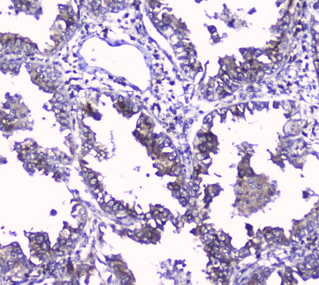 GOLPH3 Antibody in Immunohistochemistry (Paraffin) (IHC (P))