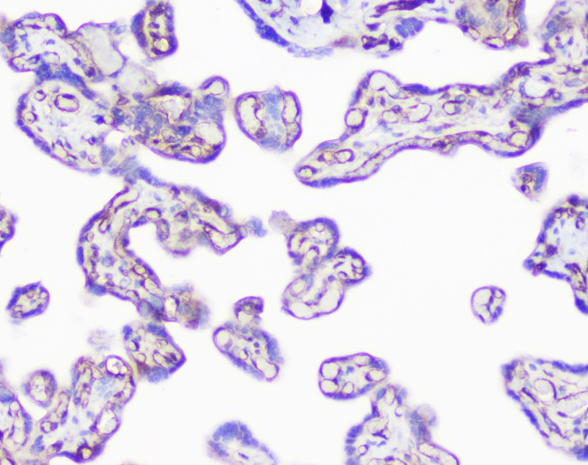 SHIP2 Antibody in Immunohistochemistry (Paraffin) (IHC (P))