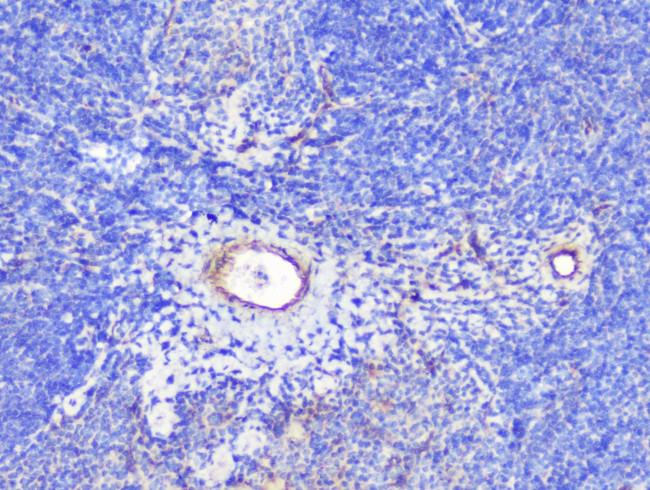 SHIP2 Antibody in Immunohistochemistry (Paraffin) (IHC (P))