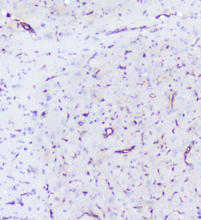 SHIP2 Antibody in Immunohistochemistry (Paraffin) (IHC (P))