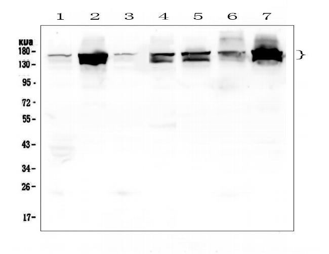 SHIP2 Antibody in Western Blot (WB)