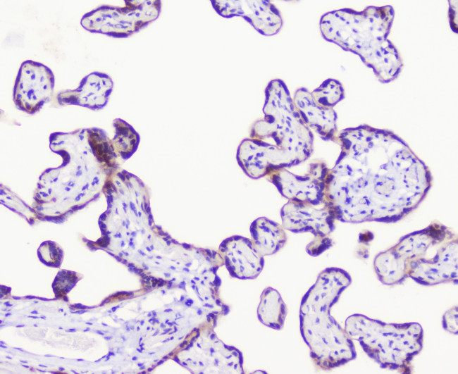 LATS1 Antibody in Immunohistochemistry (Paraffin) (IHC (P))