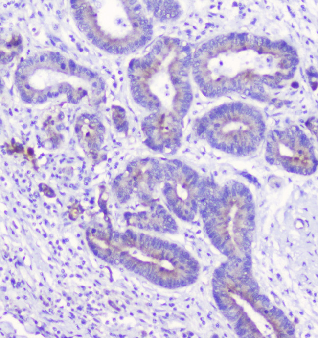 LATS1 Antibody in Immunohistochemistry (Paraffin) (IHC (P))