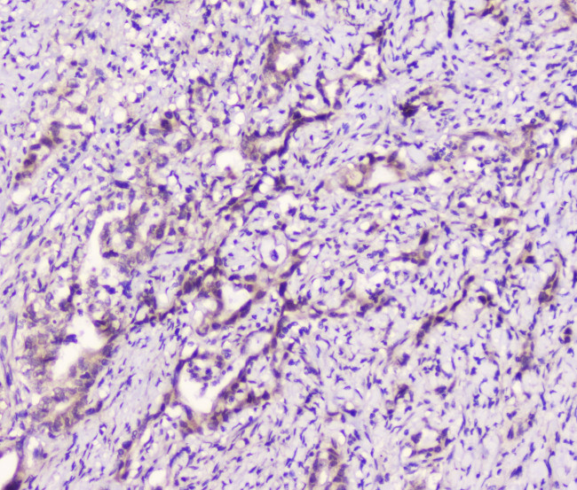 LATS1 Antibody in Immunohistochemistry (Paraffin) (IHC (P))