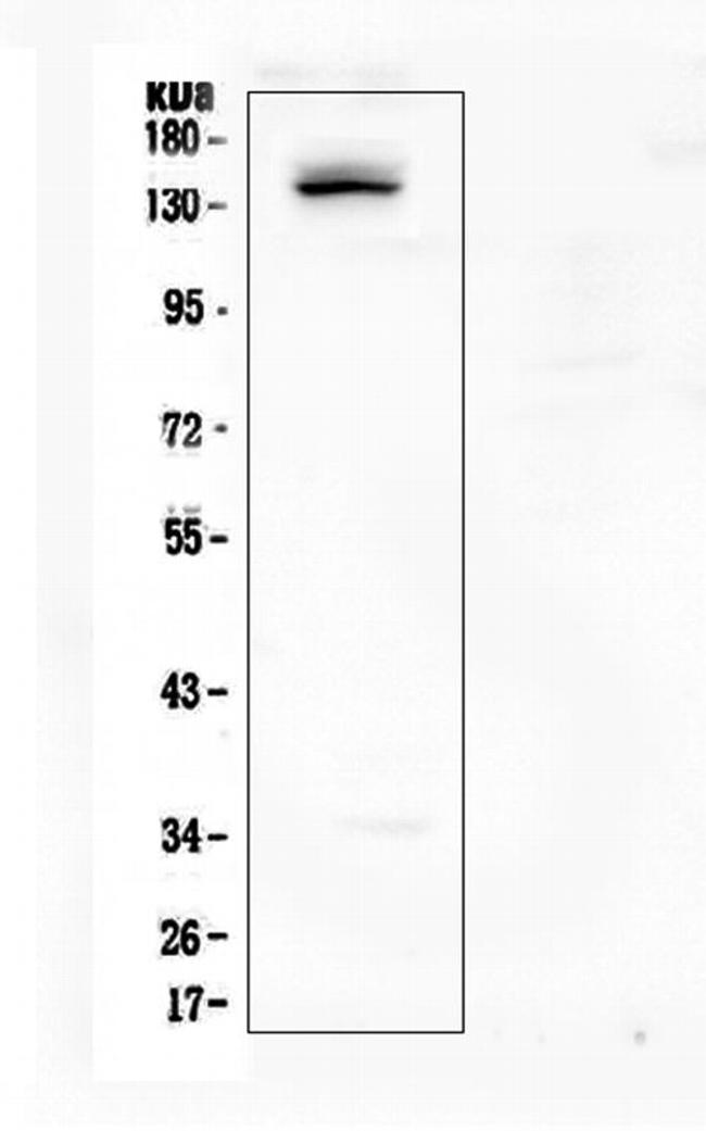 LATS1 Antibody in Western Blot (WB)