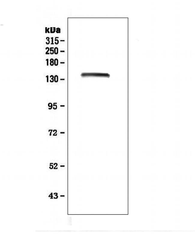 LRIG1 Antibody in Western Blot (WB)