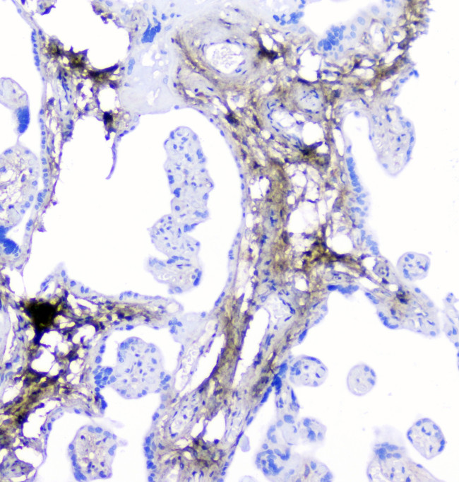 LUM Antibody in Immunohistochemistry (Paraffin) (IHC (P))