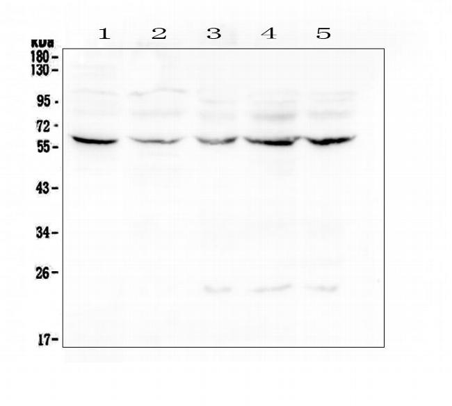 LUM Antibody in Western Blot (WB)