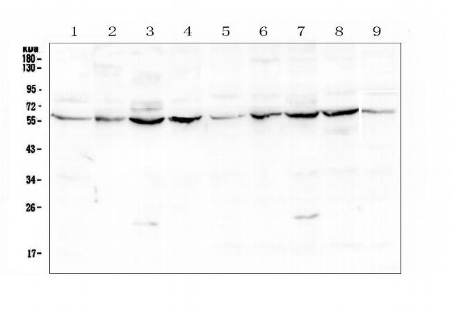 LUM Antibody in Western Blot (WB)