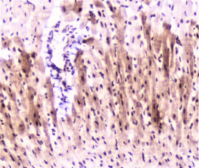 MEF2C Antibody in Immunohistochemistry (Paraffin) (IHC (P))