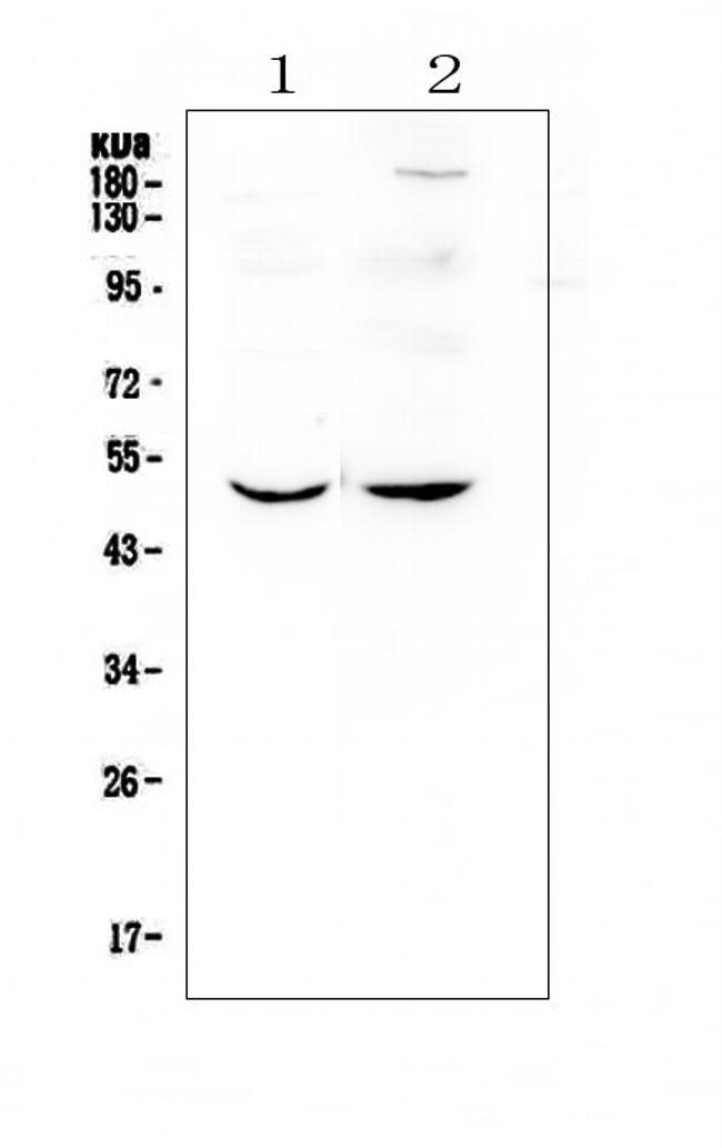 MEF2C Antibody in Western Blot (WB)