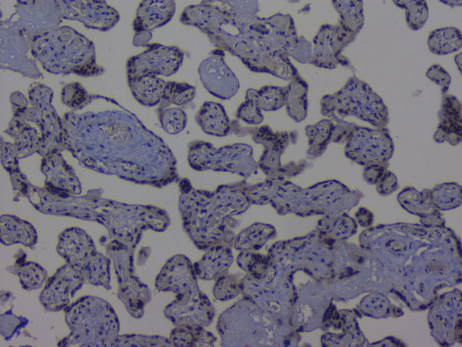 NRF1 Antibody in Immunohistochemistry (Paraffin) (IHC (P))