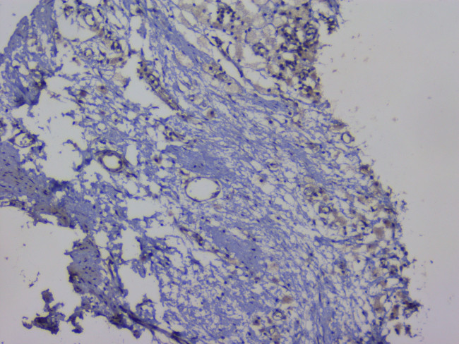 NRF1 Antibody in Immunohistochemistry (Paraffin) (IHC (P))