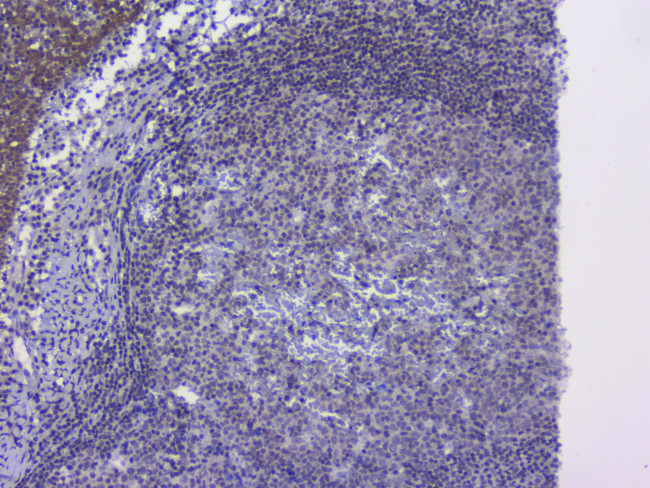 NRF1 Antibody in Immunohistochemistry (Paraffin) (IHC (P))