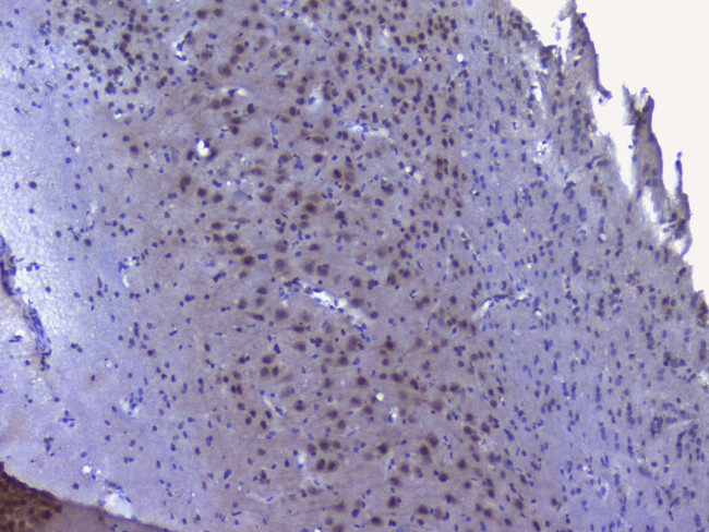 NRF1 Antibody in Immunohistochemistry (Paraffin) (IHC (P))