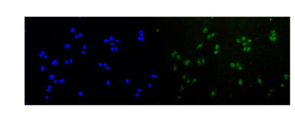 RAD51 Antibody in Immunocytochemistry (ICC/IF)