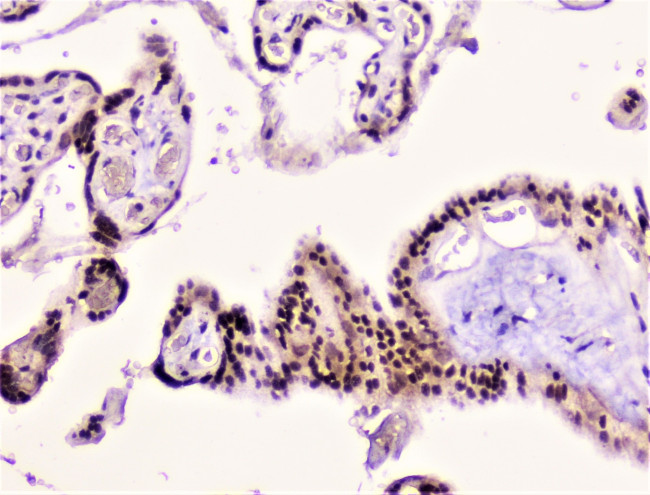 RAD51 Antibody in Immunohistochemistry (Paraffin) (IHC (P))