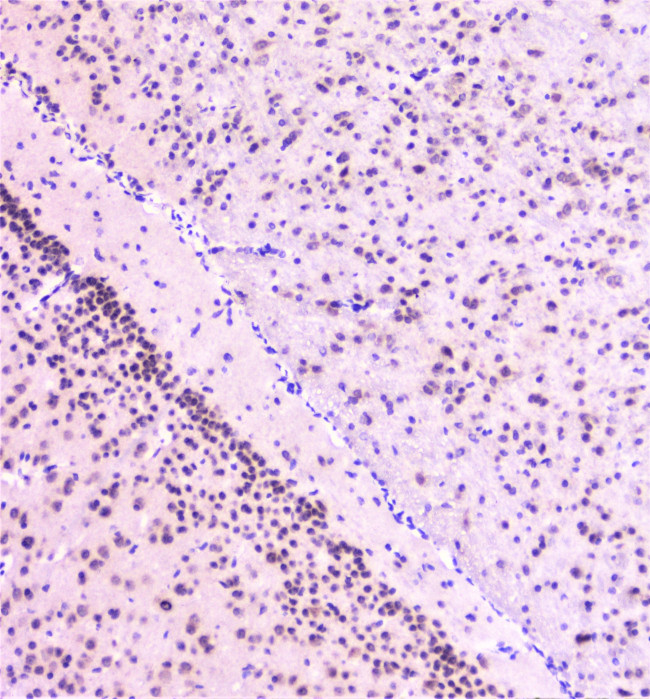 RAD51 Antibody in Immunohistochemistry (Paraffin) (IHC (P))