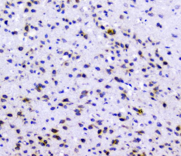 RAD51 Antibody in Immunohistochemistry (Paraffin) (IHC (P))