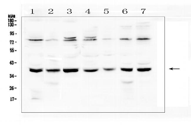 RAD51 Antibody in Western Blot (WB)