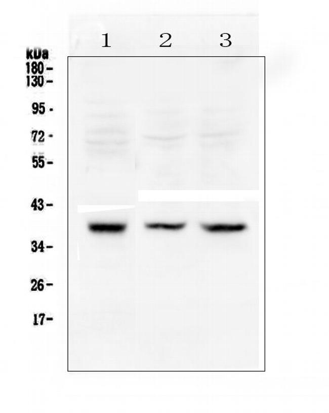 RAD51 Antibody in Western Blot (WB)