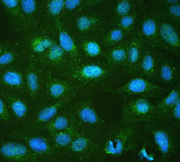 RP2 Antibody in Immunocytochemistry (ICC/IF)