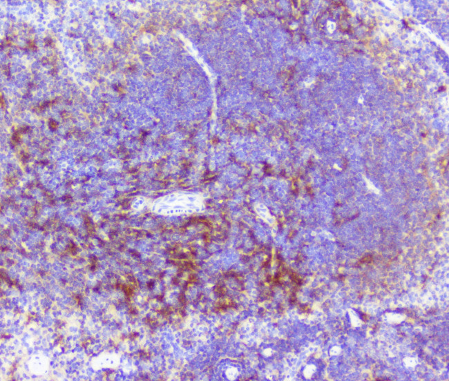 RP2 Antibody in Immunohistochemistry (Paraffin) (IHC (P))