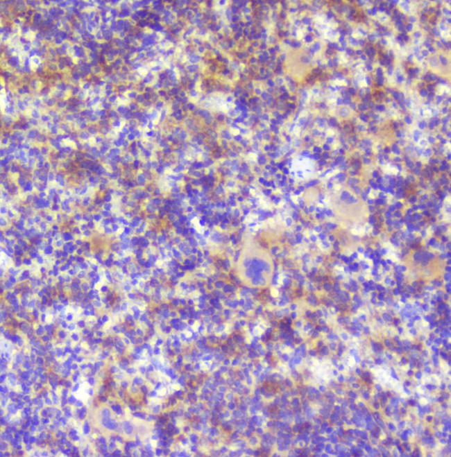 RP2 Antibody in Immunohistochemistry (Paraffin) (IHC (P))