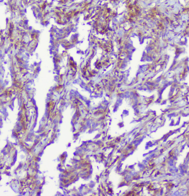 RP2 Antibody in Immunohistochemistry (Paraffin) (IHC (P))