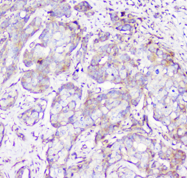 RP2 Antibody in Immunohistochemistry (Paraffin) (IHC (P))