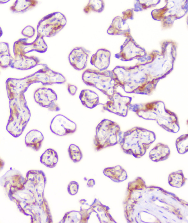 RP2 Antibody in Immunohistochemistry (Paraffin) (IHC (P))