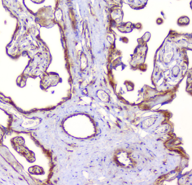 RP2 Antibody in Immunohistochemistry (Paraffin) (IHC (P))