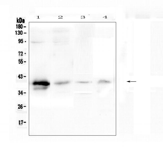 RP2 Antibody in Western Blot (WB)