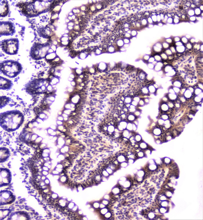 TANK Antibody in Immunohistochemistry (Paraffin) (IHC (P))