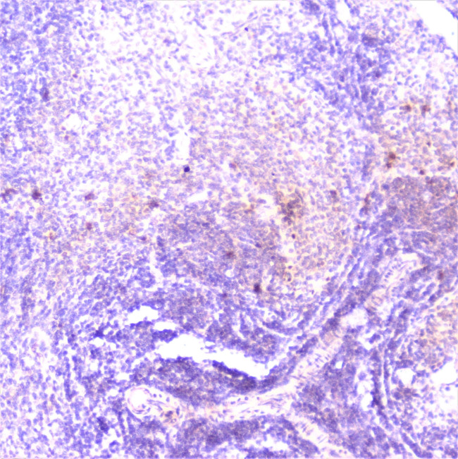 TANK Antibody in Immunohistochemistry (Paraffin) (IHC (P))