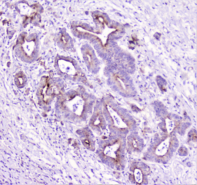 TANK Antibody in Immunohistochemistry (Paraffin) (IHC (P))