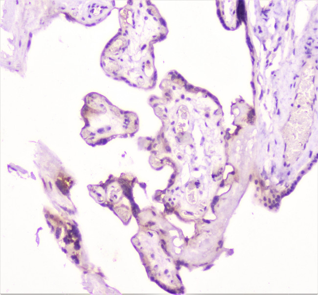 TANK Antibody in Immunohistochemistry (Paraffin) (IHC (P))