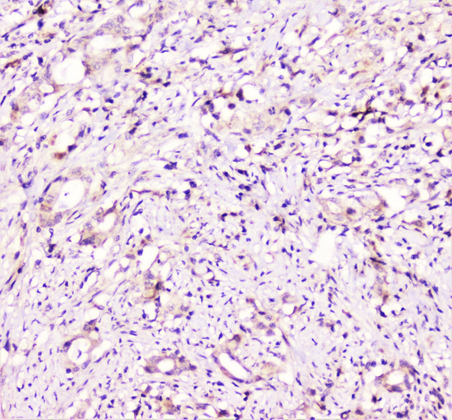 TANK Antibody in Immunohistochemistry (Paraffin) (IHC (P))