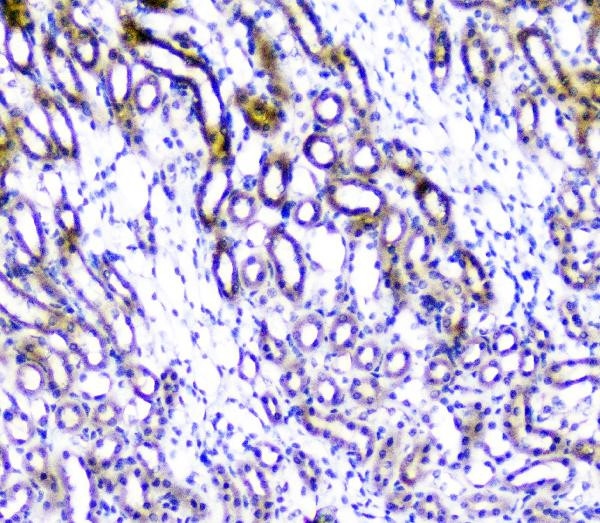 TANK Antibody in Immunohistochemistry (Paraffin) (IHC (P))