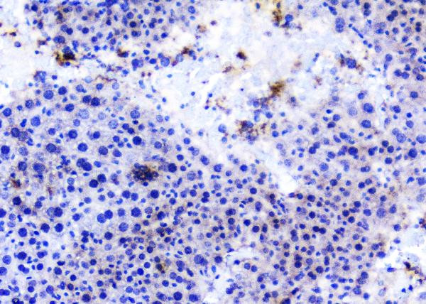 TANK Antibody in Immunohistochemistry (Paraffin) (IHC (P))