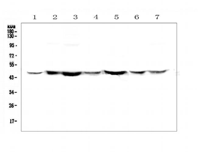 TANK Antibody in Western Blot (WB)