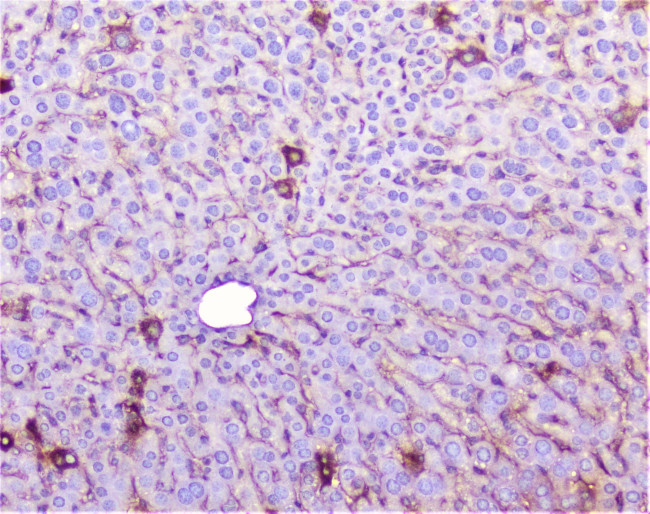 TNFR1 Antibody in Immunohistochemistry (Paraffin) (IHC (P))