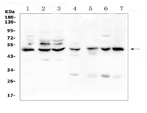 TNFR1 Antibody in Western Blot (WB)