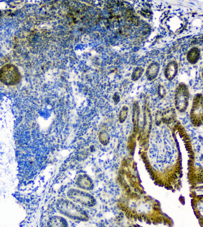 Thioredoxin 1 Antibody in Immunohistochemistry (Paraffin) (IHC (P))