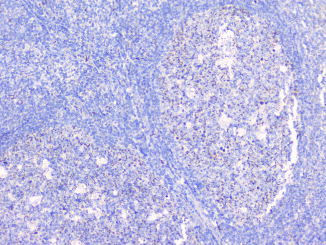 BCL6 Antibody in Immunohistochemistry (Paraffin) (IHC (P))