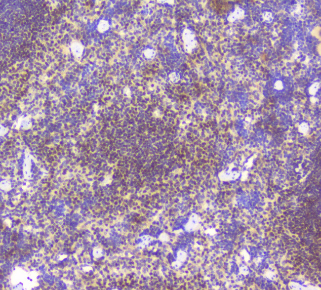 BCL6 Antibody in Immunohistochemistry (Paraffin) (IHC (P))