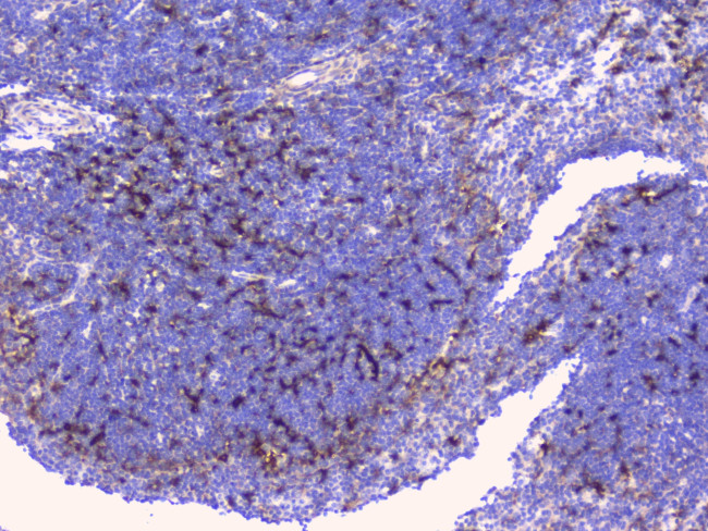 BTLA Antibody in Immunohistochemistry (Paraffin) (IHC (P))