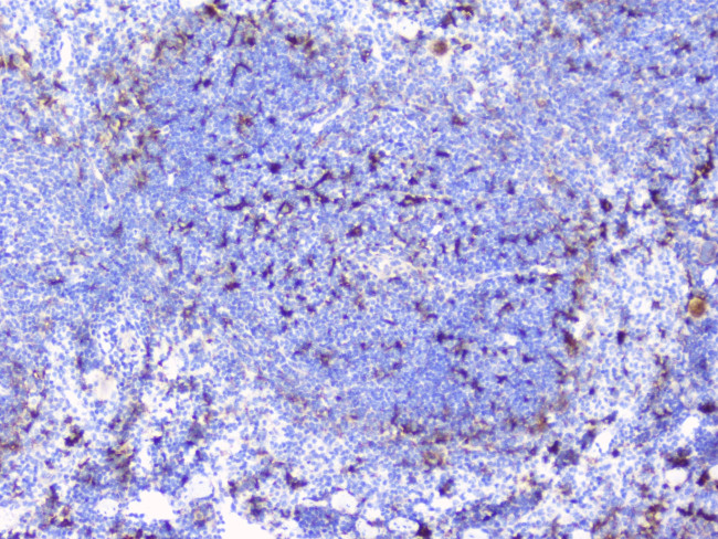 BTLA Antibody in Immunohistochemistry (Paraffin) (IHC (P))