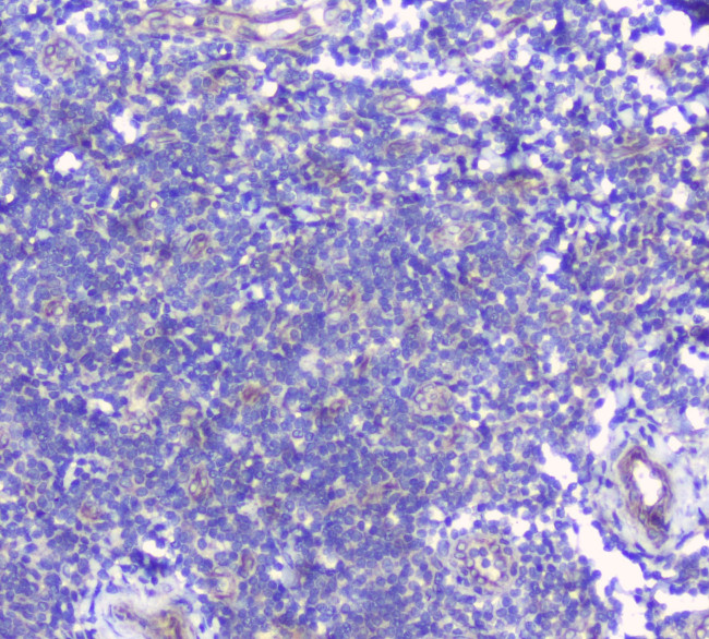 BTLA Antibody in Immunohistochemistry (Paraffin) (IHC (P))